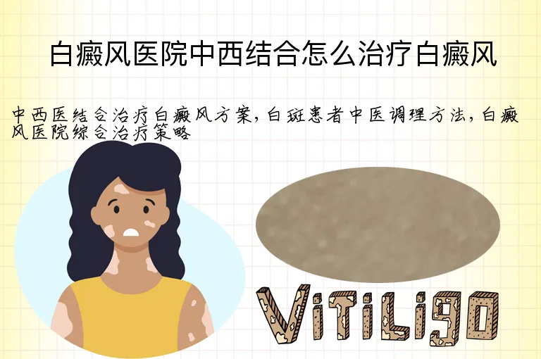 白癜风医院中西结合怎么治疗白癜风