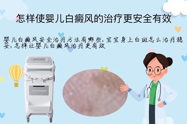 怎样使婴儿白癜风的治疗更安全有效