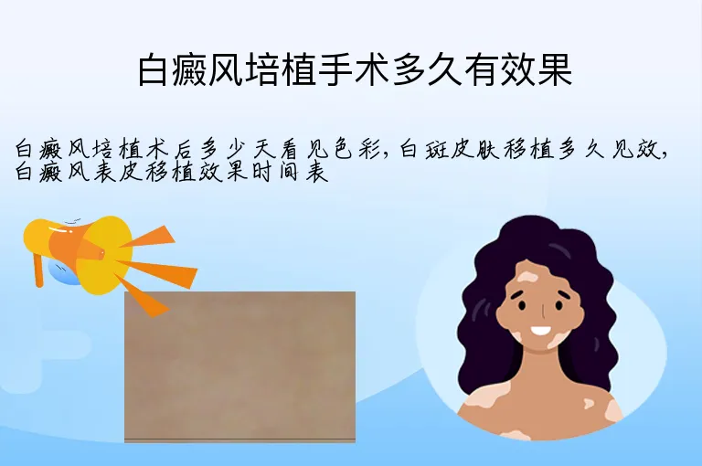 白癜风培植手术多久有效果