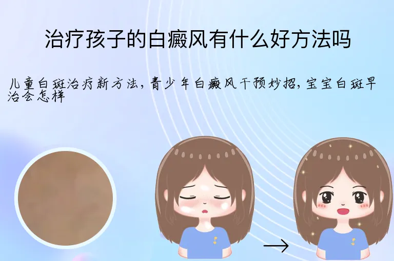 治疗孩子的白癜风有什么好方法吗