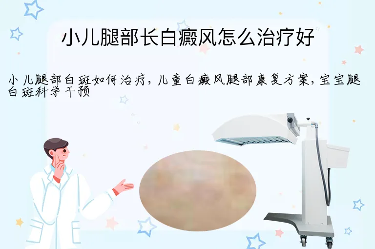 小儿腿部长白癜风怎么治疗好