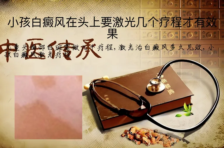 小孩白癜风在头上要激光几个疗程才有效果