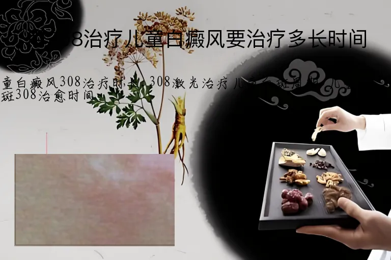 用308治疗儿童白癜风要治疗多长时间