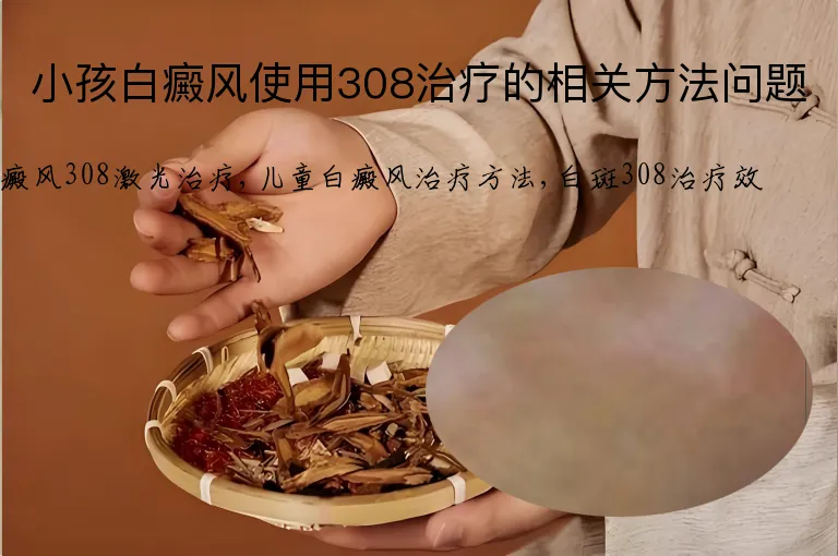 小孩白癜风使用308治疗的相关方法问题