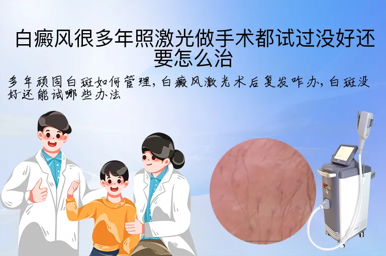 白癜风很多年照激光做手术都试过没好还要怎么治