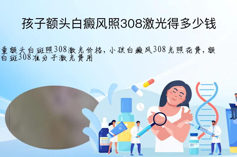 孩子额头白癜风照308激光得多少钱