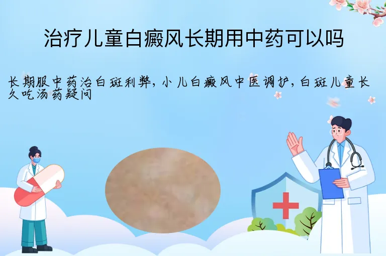 治疗儿童白癜风长期用中药可以吗