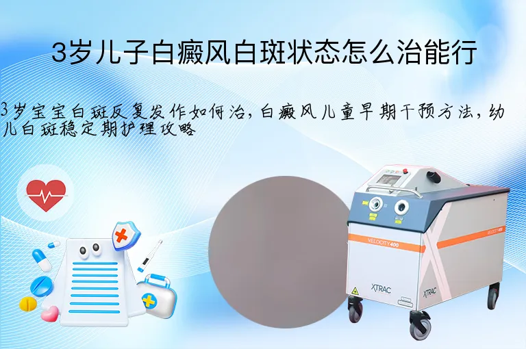 3岁儿子白癜风白斑状态怎么治能行
