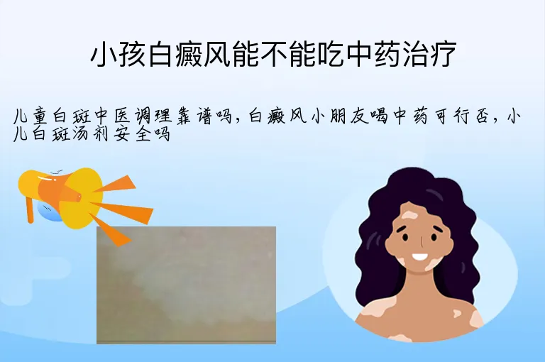 小孩白癜风能不能吃中药治疗