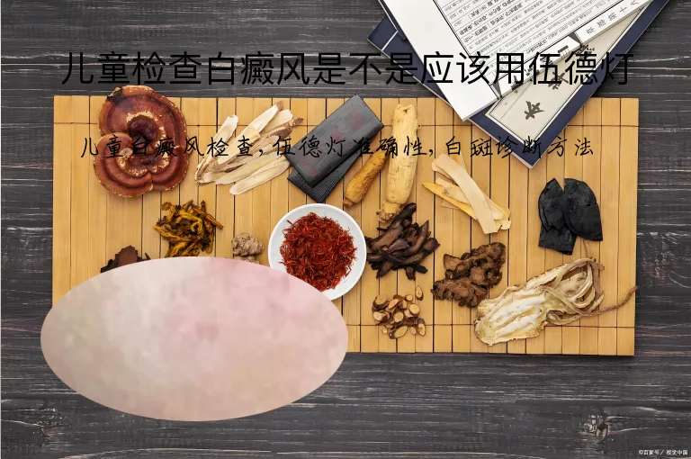 儿童检查白癜风是不是应该用伍德灯