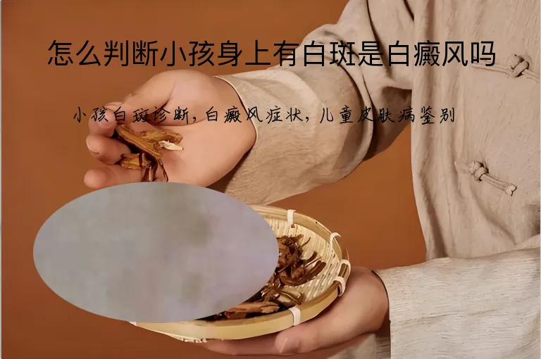 怎么判断小孩身上有白斑是白癜风吗