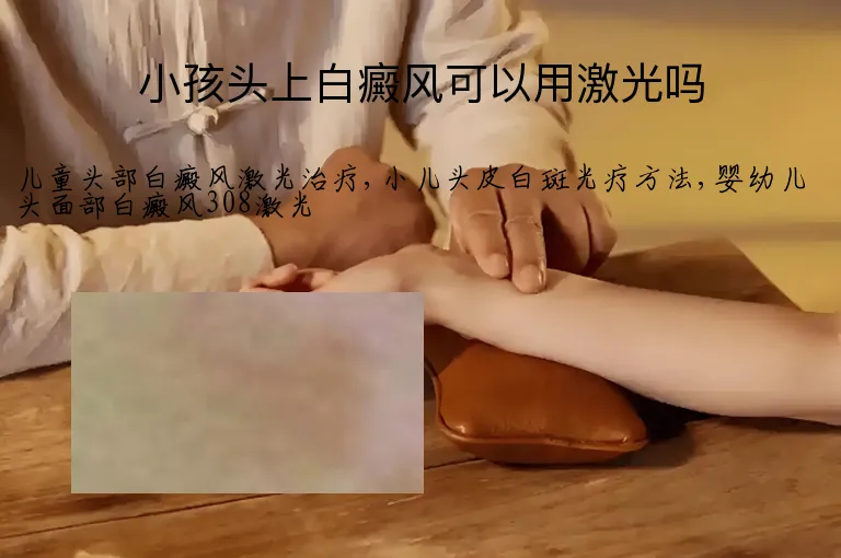 小孩头上白癜风可以用激光吗