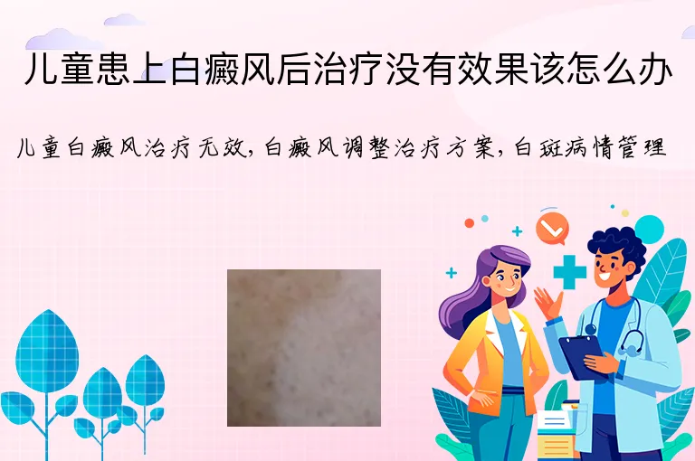 儿童患上白癜风后治疗没有效果该怎么办