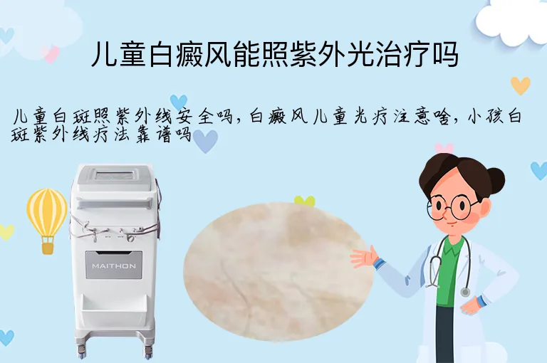 儿童白癜风能照紫外光治疗吗