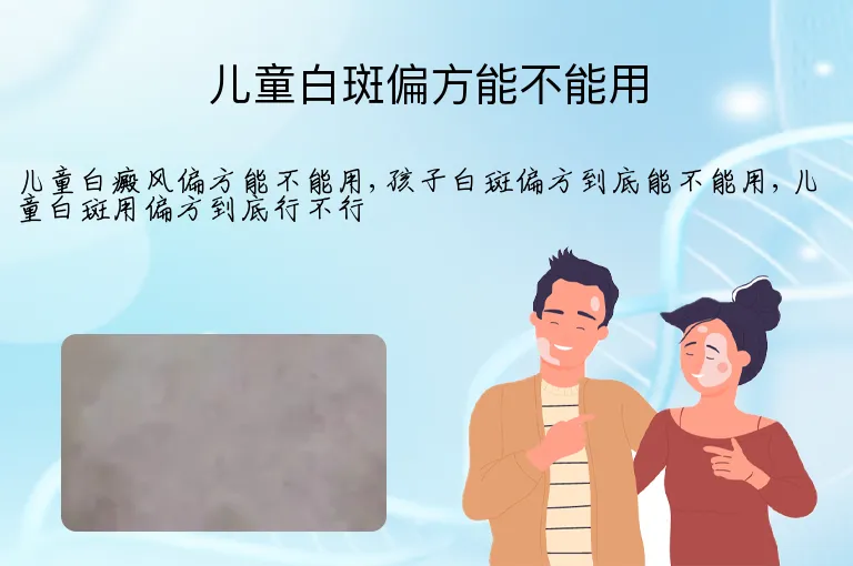 儿童白斑偏方能不能用