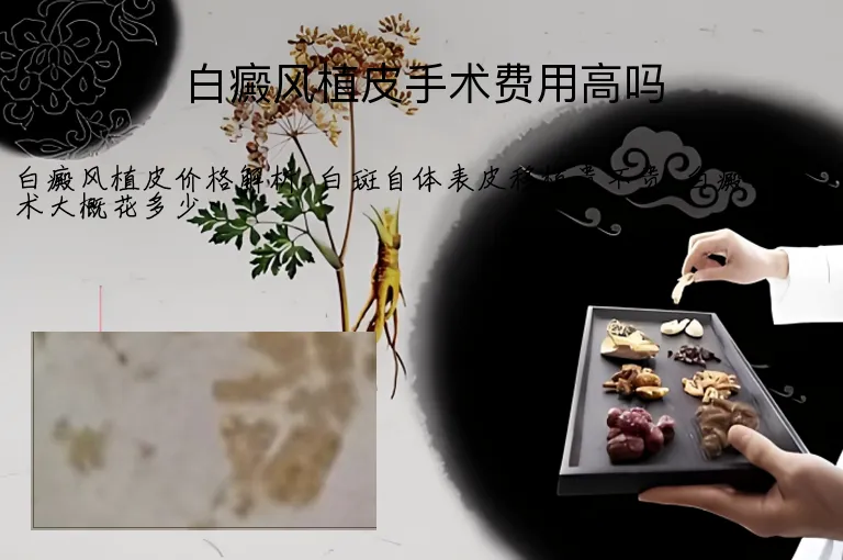 白癜风植皮手术费用高吗