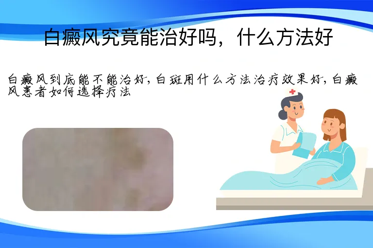 白癜风究竟能治好吗，什么方法好