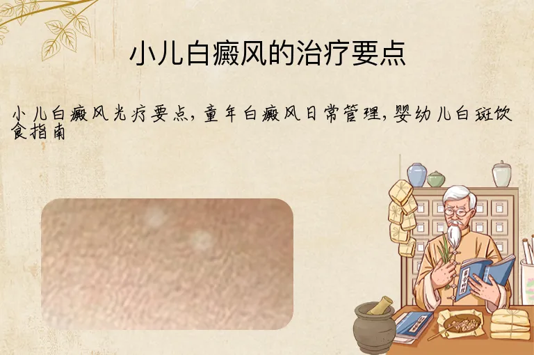 小儿白癜风的治疗要点