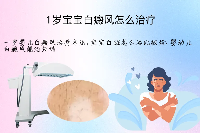 1岁宝宝白癜风怎么治疗