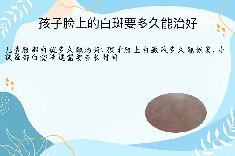 孩子脸上的白斑要多久能治好