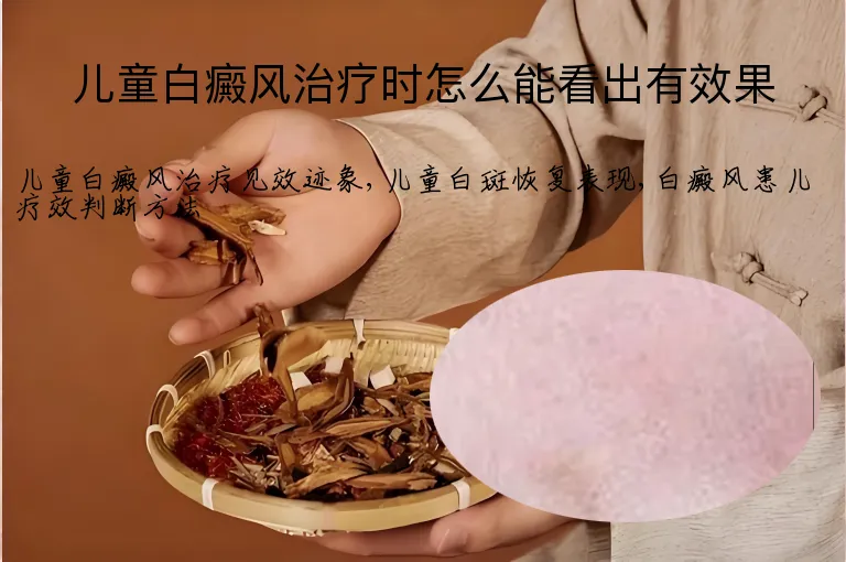 儿童白癜风治疗时怎么能看出有效果