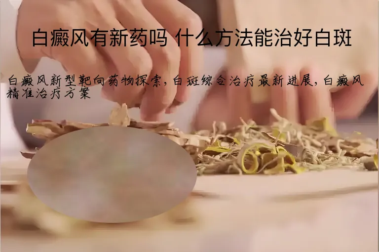白癜风有新药吗 什么方法能治好白斑