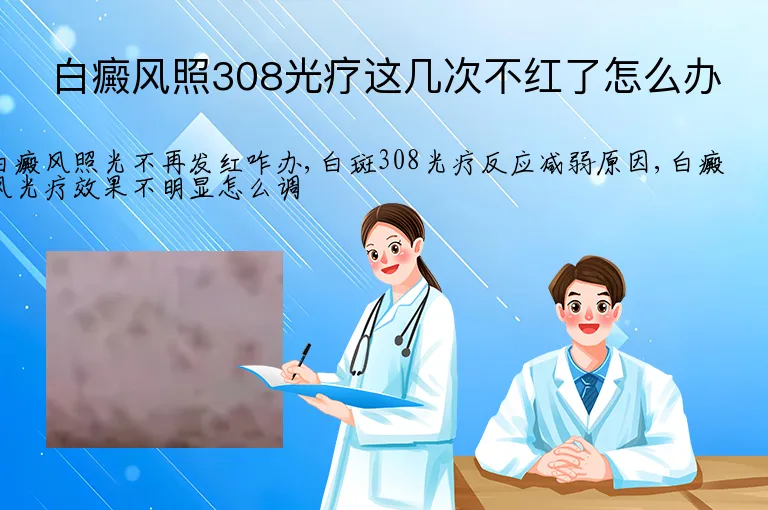白癜风照308光疗这几次不红了怎么办