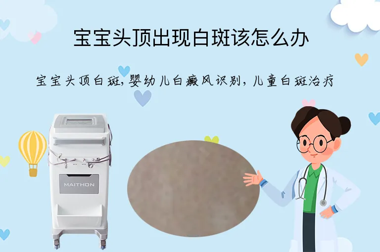 宝宝头顶出现白斑该怎么办