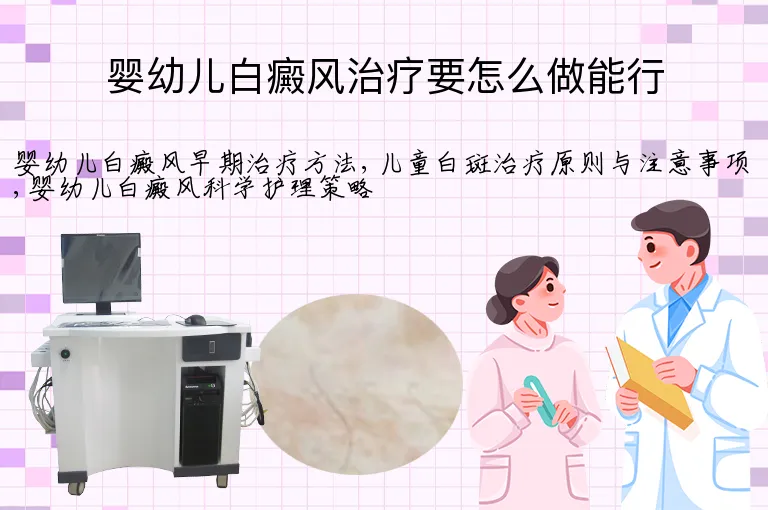 婴幼儿白癜风治疗要怎么做能行