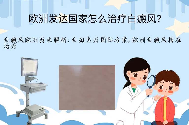 欧洲发达国家怎么治疗白癜风?