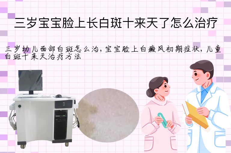 三岁宝宝脸上长白斑十来天了怎么治疗