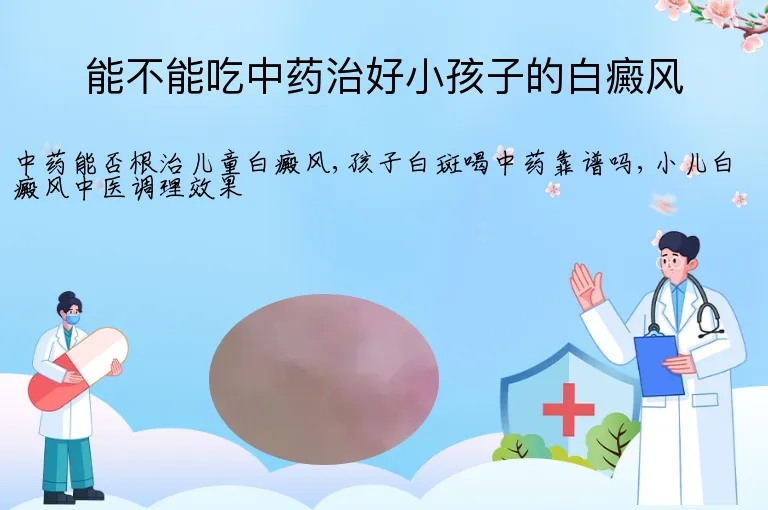 能不能吃中药治好小孩子的白癜风