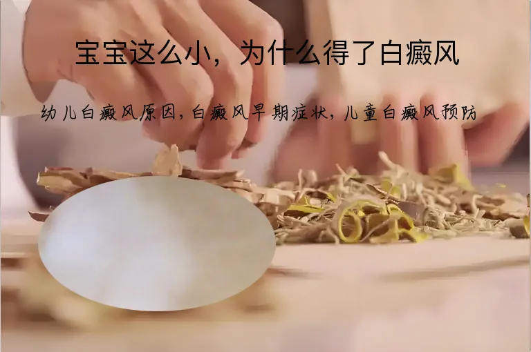 宝宝这么小，为什么得了白癜风