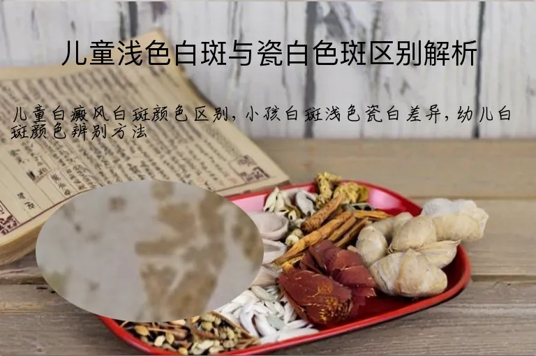 儿童浅色白斑与瓷白色斑区别解析
