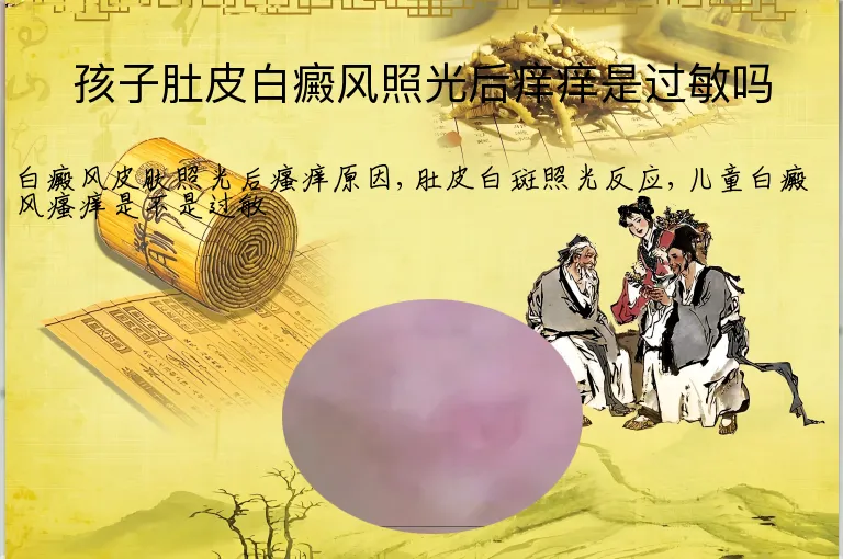 孩子肚皮白癜风照光后痒痒是过敏吗
