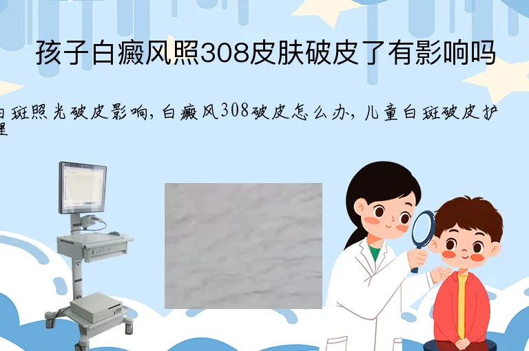 孩子白癜风照308皮肤破皮了有影响吗