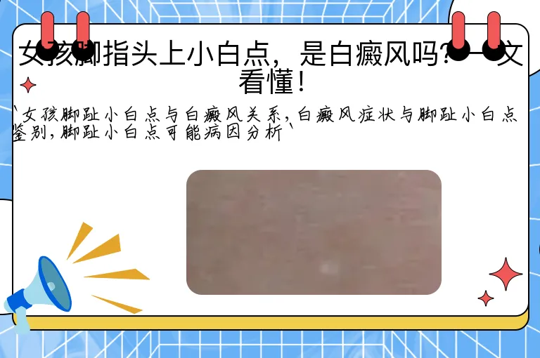 女孩脚指头上小白点，是白癜风吗？一文看懂！