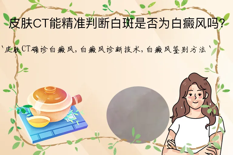 皮肤CT能精准判断白斑是否为白癜风吗？