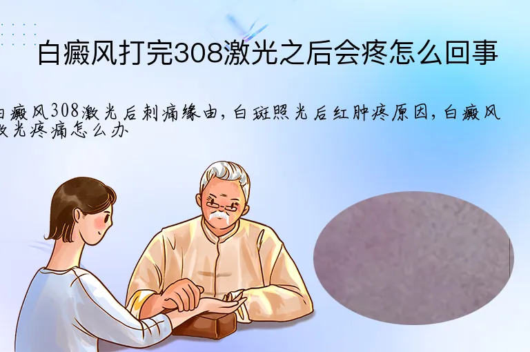 白癜风打完308激光之后会疼怎么回事