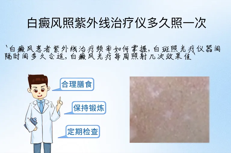 白癜风照紫外线治疗仪多久照一次
