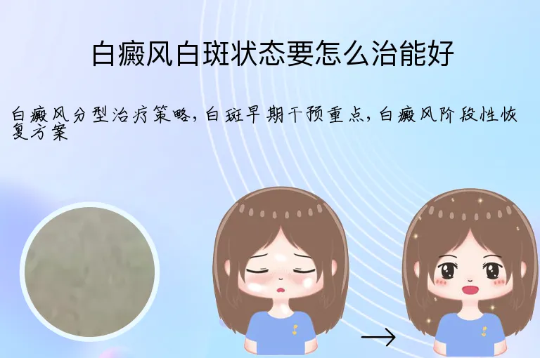 白癜风白斑状态要怎么治能好