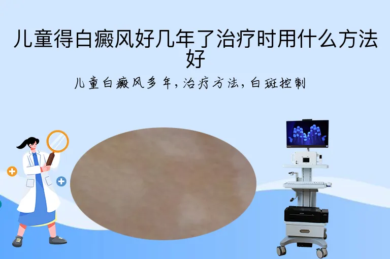 儿童得白癜风好几年了治疗时用什么方法好
