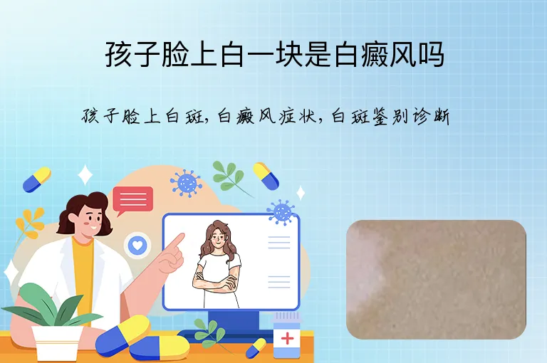 孩子脸上白一块是白癜风吗