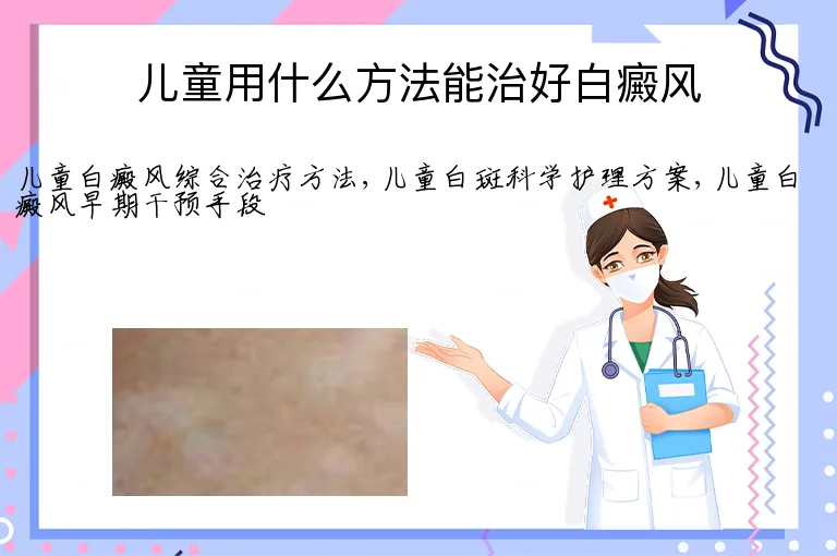 儿童用什么方法能治好白癜风