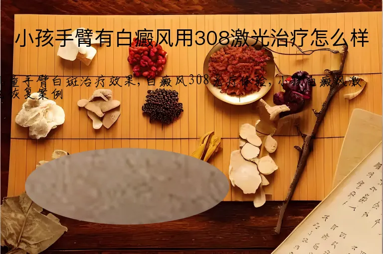 小孩手臂有白癜风用308激光治疗怎么样