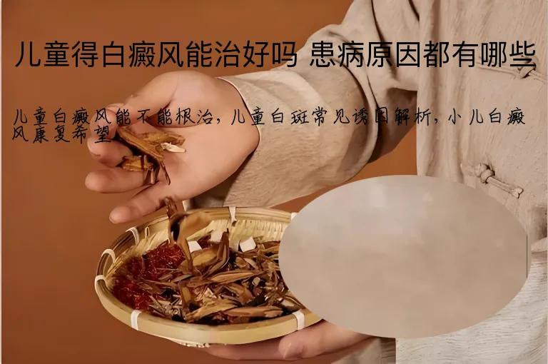 儿童得白癜风能治好吗 患病原因都有哪些