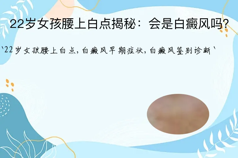 22岁女孩腰上白点揭秘：会是白癜风吗？