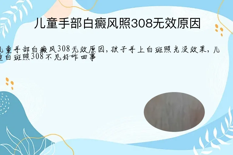 儿童手部白癜风照308无效原因