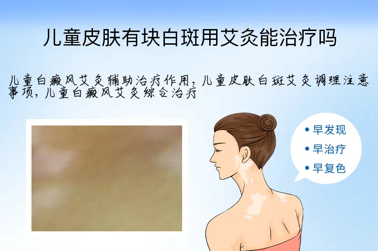 儿童皮肤有块白斑用艾灸能治疗吗