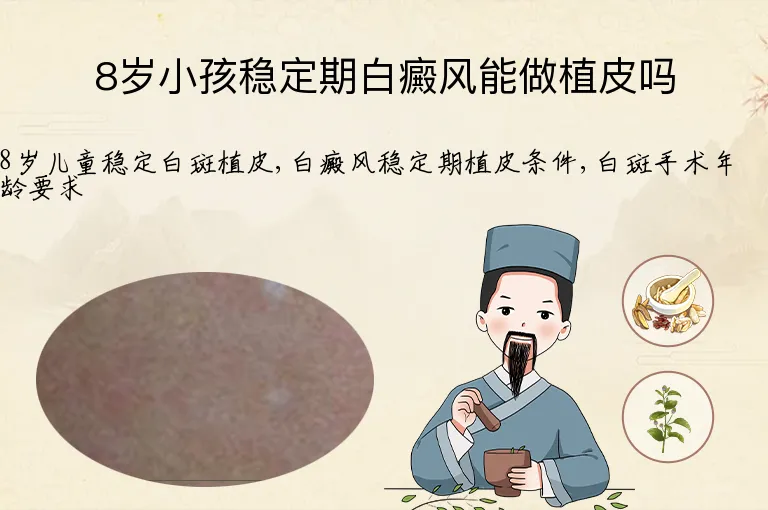 8岁小孩稳定期白癜风能做植皮吗